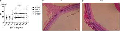 Protective effects of blocking PD-1 pathway on retinal ganglion cells in a mouse model of chronic ocular hypertension